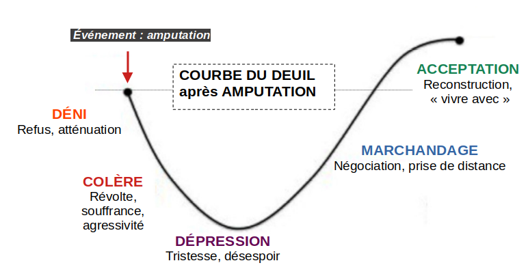 Courbe du deuil après amputation